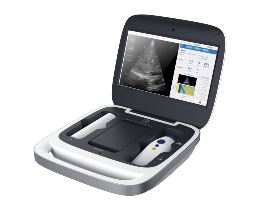 Liverscan C handheld elastography device for clinical liver assessment workflows