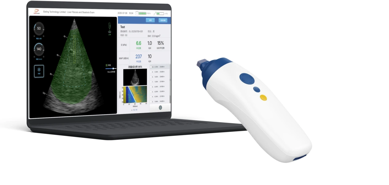 Liverscan mobile device showing compact portable liver assessment hardware design