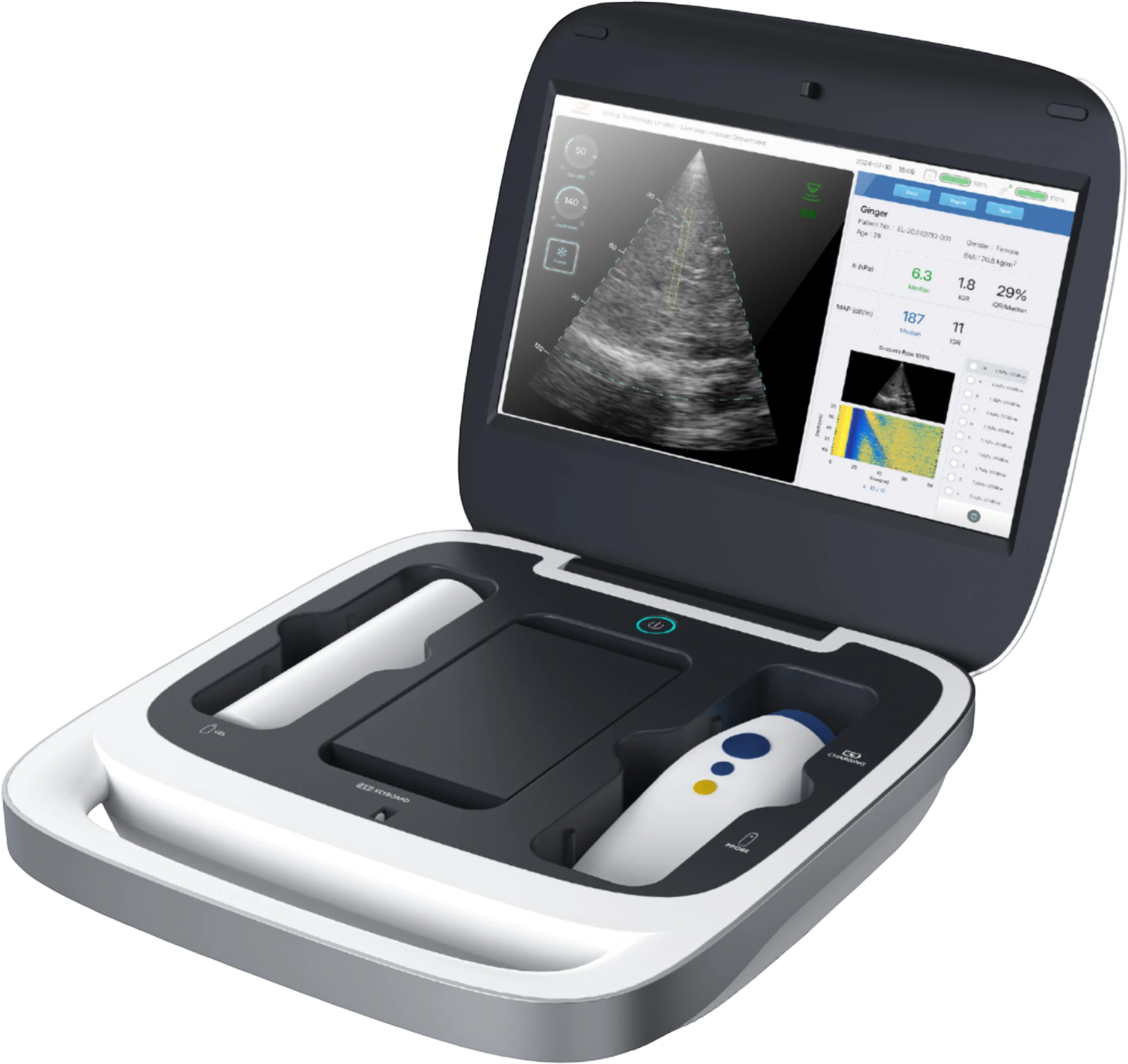 Liverscan handheld probe and tablet system for liver elastography testing